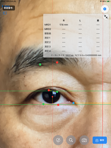 <div class='lum-box'><h4 class='fontColor_blue lum-font-size'>眼瞼計測ソフト</h4></div><div class='lum-font-cnt'>北里研究所様との共同研究で開発した撮影した画像から自動で瞼等の寸法を計測するアプリとなります
従来の実物大の画像からの定規による計測をアプリが行います</div>