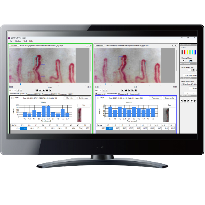 <div class='lum-box'><h4 class='fontColor_blue lum-font-size'>毛細血管流速計測ソフトGOKO-VIP</h4></div><div class='lum-font-cnt'>血流の速さを定量化しませんか？これまで感覚的に判断していた「速め」「遅め」などの血流速を、数値で定量化。直感的に操作できる簡単な3ステップで、誰でもスムーズに計測可能。お客様の声から生まれたGOKO独自の毛細血管流速計測で、医療、美容、健康の幅広い分野で、臨床研究やエビデンス取得に貢献します。</div>