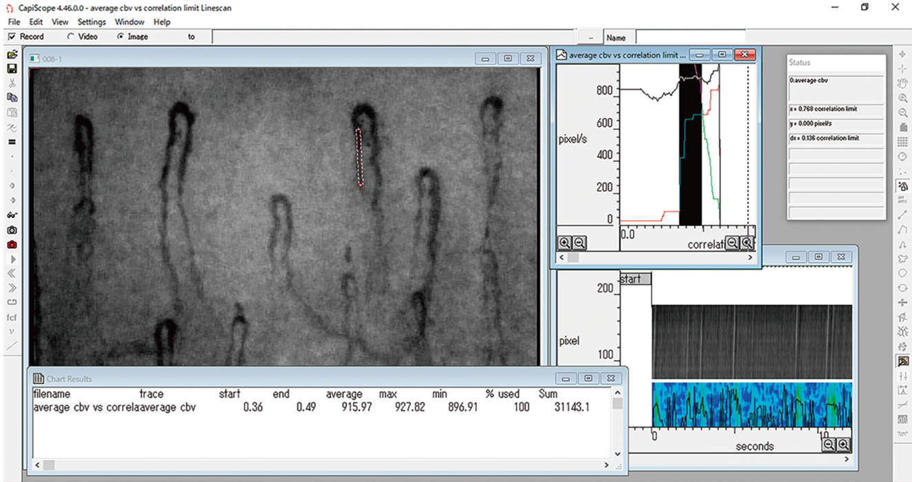 <div class='lum-box'><h4 class='fontColor_blue lum-font-size'>血管血流画像解析ソフト Capimetrics</h4></div><div class='lum-font-cnt'>主に研究、開発向けの商品ですが、血管血流画像解析ソフトを取り扱っております。(130以上の論文有)
1秒間に60コマを取り込み、正確な解析ができます。高速ブレ補正機能により画面外へ飛び出してしまうなどの大きなブレでない限り解析可能です。「流速」「直径」「密度」「長さ」を解析することができます。</div>